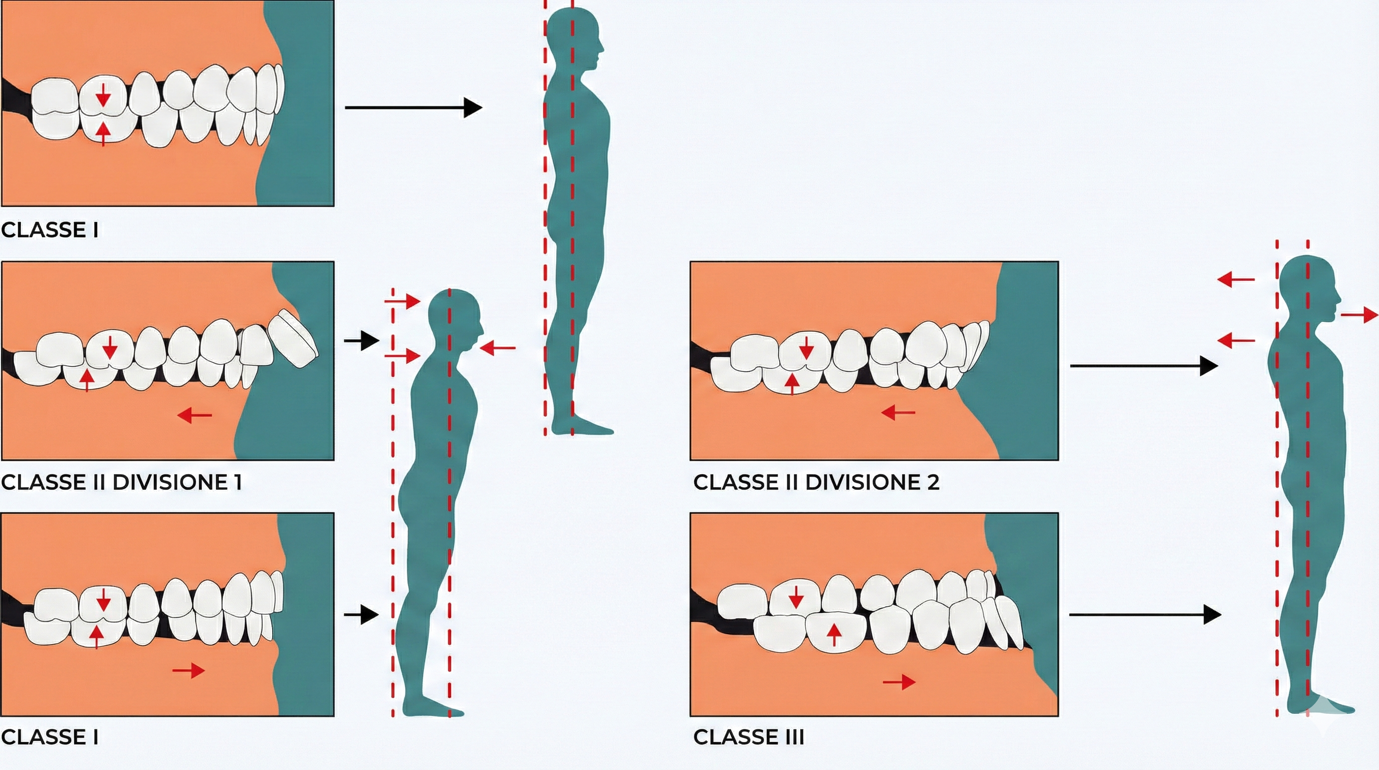 Posturologia Occlusale